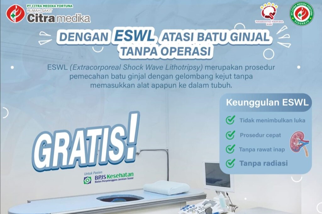 Dengan ESWL Atasi Batu Ginjal Tanpa Operasi 